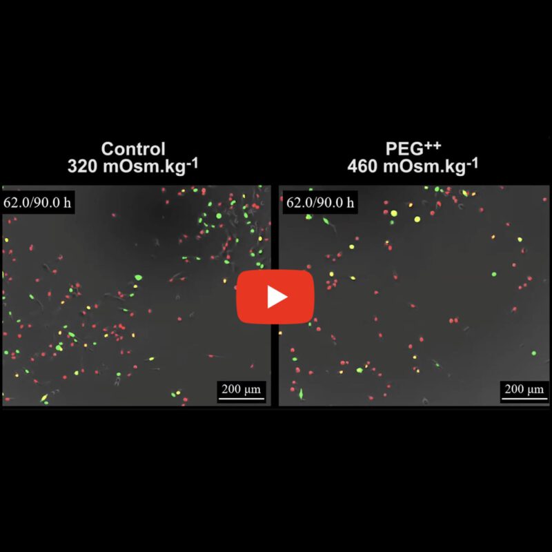 Breast cancer cell cycle dynamics under isotonic and hyperosmotic stress